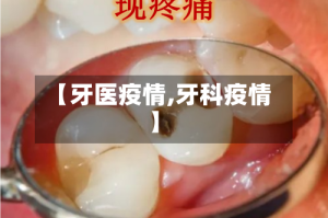 【牙医疫情,牙科疫情】