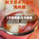 【牙医疫情,牙科疫情】