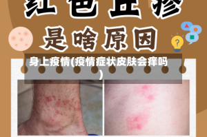 身上疫情(疫情症状皮肤会痒吗)