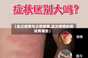 【此次疫情与之前疫情,此次疫情的症状有哪些】