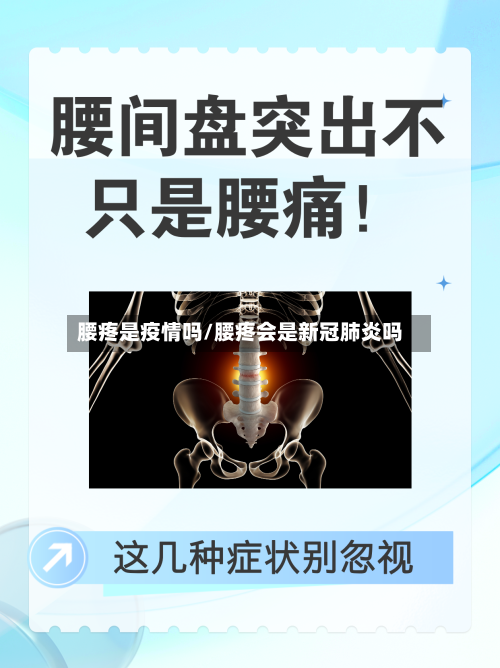 腰疼是疫情吗/腰疼会是新冠肺炎吗-第2张图片