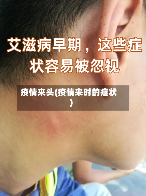 疫情来头(疫情来时的症状)-第1张图片
