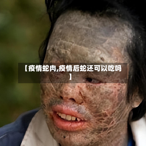 【疫情蛇肉,疫情后蛇还可以吃吗】-第1张图片