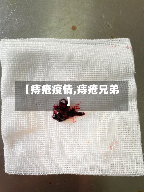 【痔疮疫情,痔疮兄弟】-第1张图片