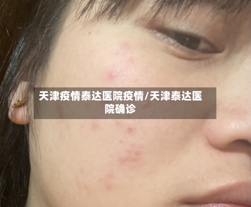 天津疫情泰达医院疫情/天津泰达医院确诊-第2张图片