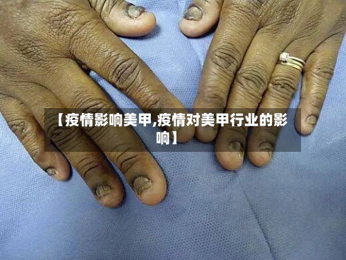 【疫情影响美甲,疫情对美甲行业的影响】-第2张图片