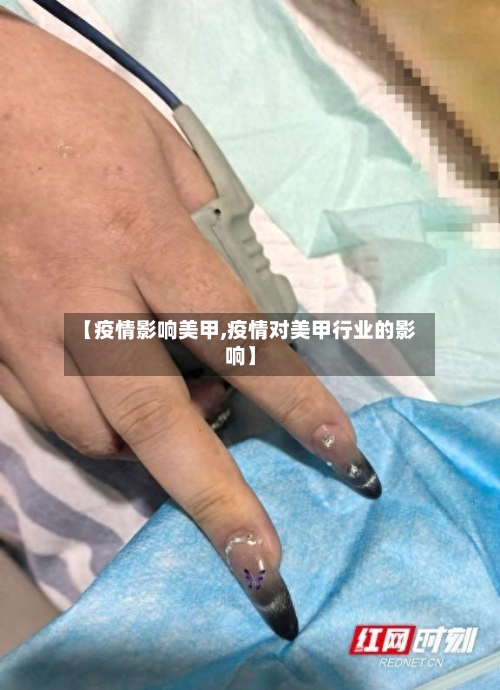 【疫情影响美甲,疫情对美甲行业的影响】-第1张图片