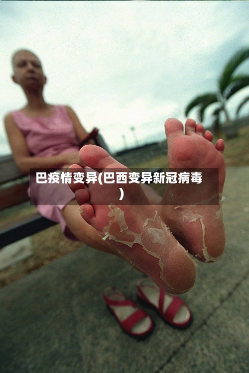 巴疫情变异(巴西变异新冠病毒)-第1张图片